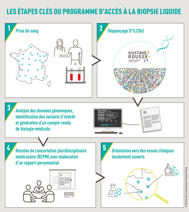 Biopsie Fresh infographie