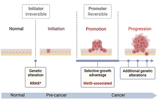 Un schéma illustre le processus multi-étapes du développement tumoral de gauche à droite. À l’extrême gauche, une rangée de cellules normales. Dans la phase dite d’“Initiation”, une cellule acquiert une mutation oncogénique de KRAS (en rose). Dans la phase de “Promotion”, un amas de ces cellules altérées prolifère, indiquant une croissance sélective (influencée par des facteurs liés au syndrome métabolique). Dans la phase de “Progression” à droite, la tumeur grossit et acquiert des altérations génétiques supplémentaires. Le diagramme identifie ces étapes comme “Normal”, “Pré-cancer” et “Cancer”, illustrant comment une première modification génétique irréversible (mutation de KRAS), combinée à des facteurs promoteurs réversibles, conduit à l’expansion tumorale et finalement à la transformation maligne.